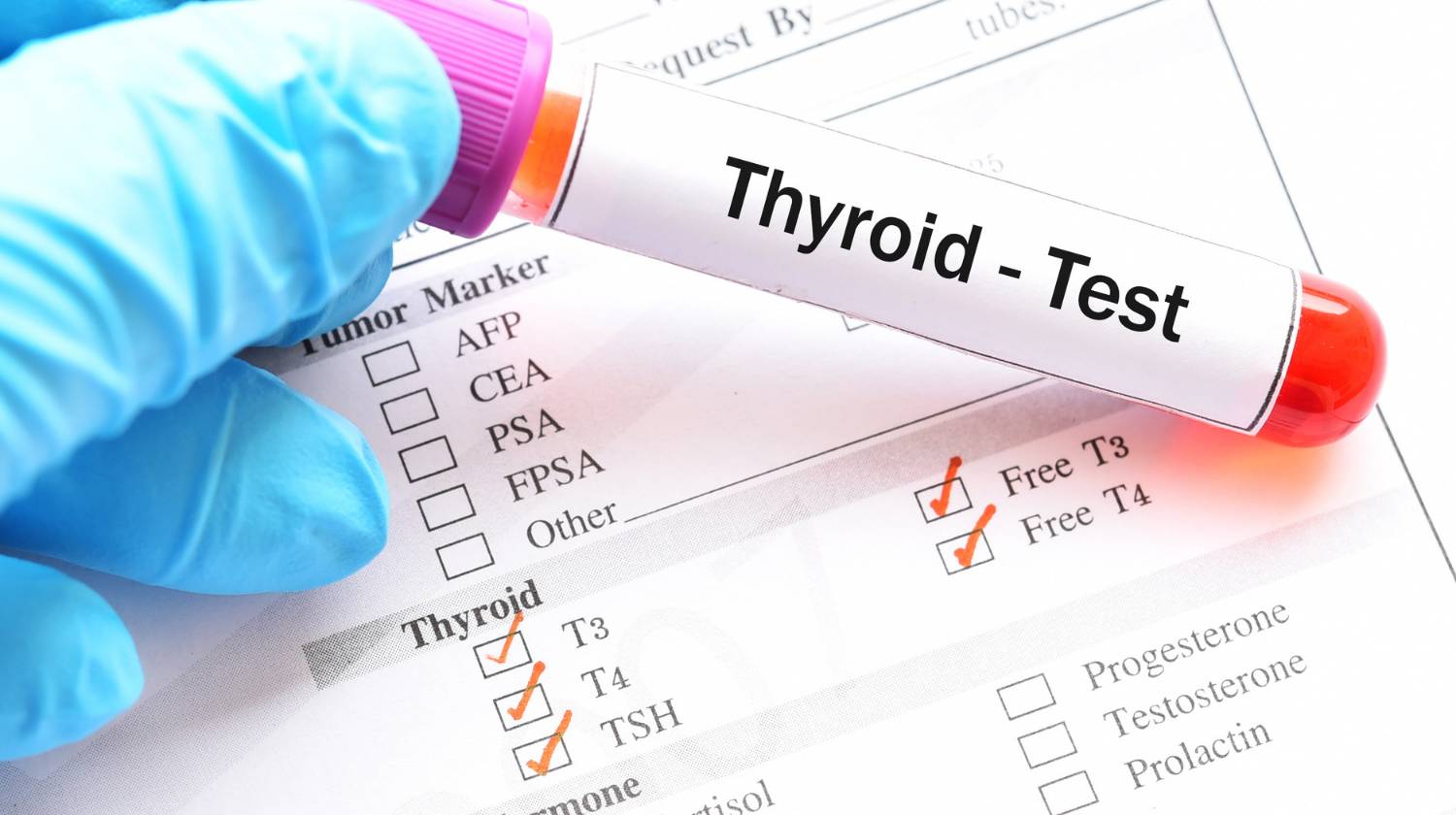 Thyroid Profile Test in tathawade Pathology Lab