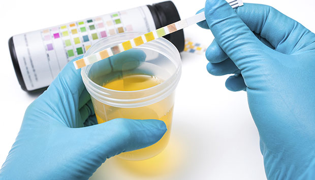 Urine Test Pathology Lab in tathawade Lifeline Laboratory